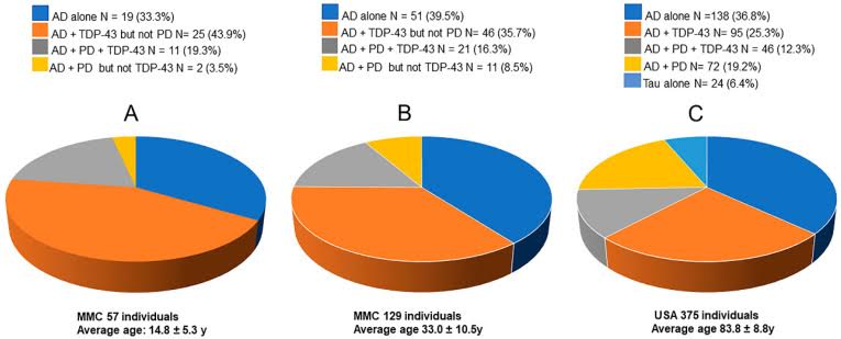 Calderon's Chart on Brain Damage by Age — showing AD (Alzheimer's Disease), PD (Parkinson's Disease) and TDP (frontal temporal atrophy) markers across age groups